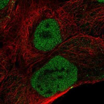 Immunocytochemistry/ Immunofluorescence OVCA2 Antibody - BSA Free