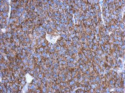 Immunohistochemistry-Paraffin OVCA2 Antibody