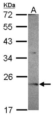 Western Blot OVCA2 Antibody