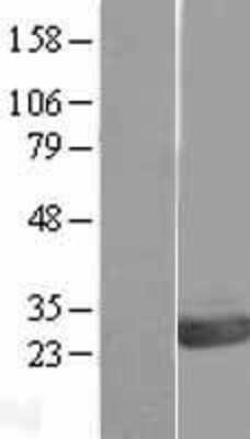 Western Blot OVCA2 Overexpression Lysate