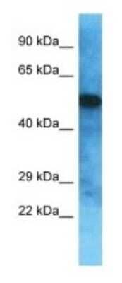 Western Blot: OVCH2 Antibody [NBP3-09872] - Western blot analysis of OVCH2 in Jurkat Whole Cell lysates. Antibody dilution at 1.0ug/ml