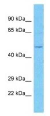 Western Blot: OVCH2 Antibody [NBP3-09873] - Western blot analysis of OVCH2 in Jurkat Whole Cell lysates. Antibody dilution at 1.0ug/ml