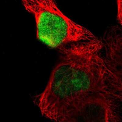 Immunocytochemistry/ Immunofluorescence OVOL1 Antibody