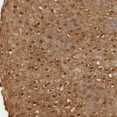 Immunohistochemistry-Paraffin OVOL1 Antibody