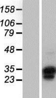 Western Blot OVOL1 Overexpression Lysate