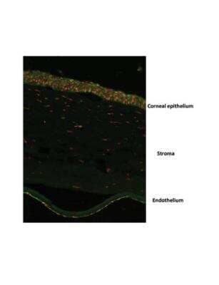 Immunohistochemistry: OVOL2 Antibody [NBP2-82298]