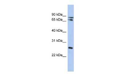 Western Blot: OVOL2 Antibody [NBP2-82297] - WB Suggested Anti-OVOL2 Antibody Titration: 0.2-1 ug/ml. ELISA Titer: 1:62500. Positive Control: HT1080 cell lysate