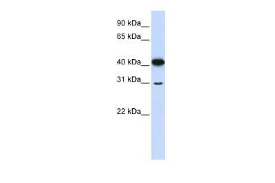 Western Blot: OVOL2 Antibody [NBP2-82298] - WB Suggested Anti-OVOL2 Antibody Titration: 0.2-1 ug/ml. ELISA Titer: 1:312500. Positive Control: 721_B cell lysate