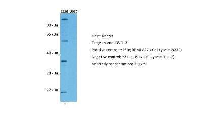 Western Blot: OVOL2 Antibody [NBP2-82299] - Host: Rabbit. Target: OVOL2. Positive control (+): RPMI-8226 (N12). Negative control (-): U937 (N31). Antibody concentration: 2ug/ml