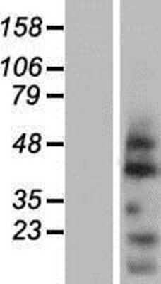 Western Blot: OVOL2 Overexpression Lysate (Adult Normal) [NBP2-06543] Left-Empty vector transfected control cell lysate (HEK293 cell lysate); Right -Over-expression Lysate for OVOL2.