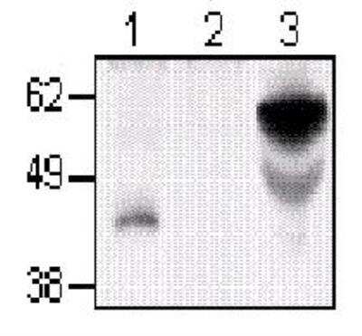 Immunoprecipitation: OX40/TNFRSF4 Antibody (7D6) [NB100-64375] - Lane 1 - Feline CD134 expressing cells lane 2 - Control cells lane 3 - Recombinant feline CD134-Fc fusion protein clone 7D6 used at 1ug/ml.