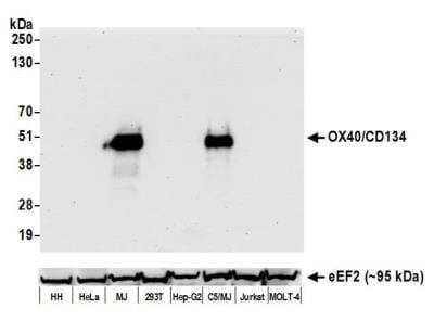 Western Blot: OX40/TNFRSF4 Antibody (BLR042F) [NBP2-76421] - Detection of human OX40/CD134 by WB of HH, HeLa, MJ, HEK293T, Hep-G2, C5/MJ, Jurkat, and MOLT-4 lysate. Antibody: Rabbit anti-OX40/CD134 recombinant monoclonal [BLR042F] (NBP2-76421). Secondary: HRP-conjugated goat anti-rabbit IgG.