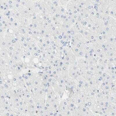 Immunohistochemistry-Paraffin: OXCT1 Antibody [NBP1-82462] - Staining of human liver shows no positivity in hepatocytes as expected.