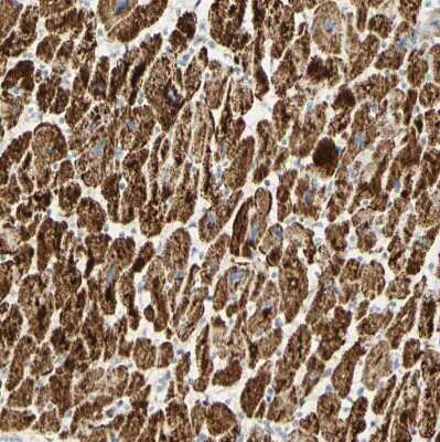 Immunohistochemistry-Paraffin: OXCT1 Antibody [NBP1-82462] - Staining of human heart muscle shows strong cytoplasmic positivity in cardiomyocytes.