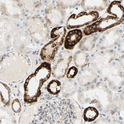 Immunohistochemistry-Paraffin: OXCT1 Antibody [NBP1-82462] - Staining of human kidney shows strong cytoplasmic positivity in cells in tubules.