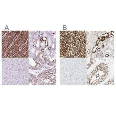 Immunohistochemistry-Paraffin OXCT1 Antibody - BSA Free