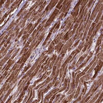 Immunohistochemistry-Paraffin OXCT1 Antibody - BSA Free