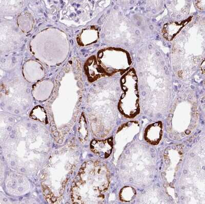 Immunohistochemistry-Paraffin OXCT1 Antibody - BSA Free