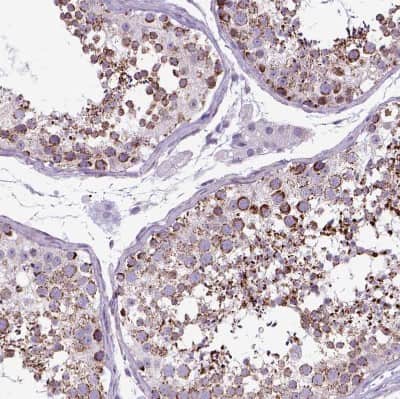 Immunohistochemistry-Paraffin OXCT1 Antibody - BSA Free