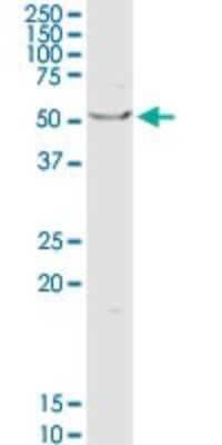 Western Blot OXCT1 Antibody - Azide and BSA Free