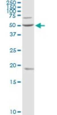 Western Blot OXCT1 Antibody - Azide and BSA Free