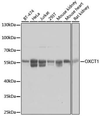 Western Blot: OXCT1 Antibody [NBP3-03623] - Analysis of extracts of various cell lines, using OxCT1 antibody at 1:3000 dilution. Secondary antibody: HRP Goat Anti-Rabbit IgG (H+L) at 1:10000 dilution. Lysates/proteins: 25ug per lane. Blocking buffer: 3% nonfat dry milk in TBST. Detection: ECL Basic Kit.