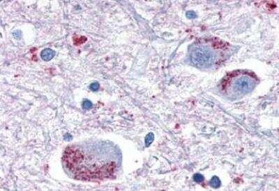 Immunohistochemistry-Paraffin: OXGR1/GPR80/P2Y15 Antibody [NLS1867] - Brain, Thalamus, neurons and glia.