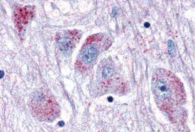 Immunohistochemistry-Paraffin: OXGR1/GPR80/P2Y15 Antibody [NLS1867] - Brain, Hypothalamus, neurons of the Adjacent Basal Nucleus of Meynert.