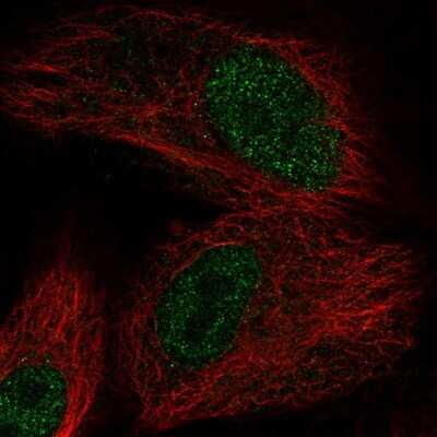 Immunocytochemistry/Immunofluorescence: OXNAD1 Antibody [NBP2-58060] - Staining of human cell line A549 shows localization to nucleus.