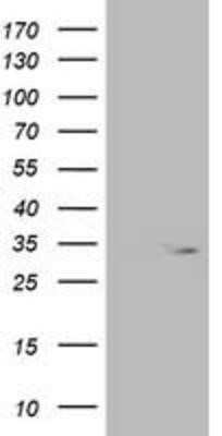 Western Blot: OXNAD1 Antibody (OTI1D1) - Azide and BSA Free [NBP2-73175] - HEK293T cells were transfected with the pCMV6-ENTRY control (Left lane) or pCMV6-ENTRY OXNAD1 (Right lane) cDNA for 48 hrs and lysed. Equivalent amounts of cell lysates (5 ug per lane) were separated by SDS-PAGE and immunoblotted with anti-OXNAD1.
