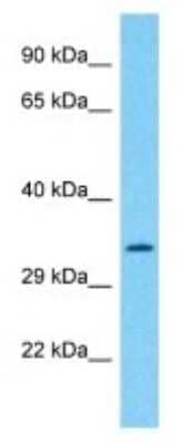 Western Blot: OXNAD1 Antibody [NBP3-09874] - Western blot analysis of OXNAD1 in Hela Whole Cell lysates. Antibody dilution at 1.0ug/ml