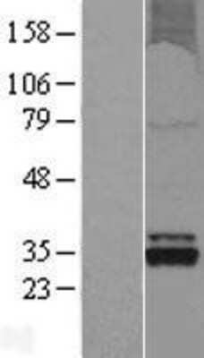 Western Blot: OXNAD1 Overexpression Lysate (Adult Normal) [NBL1-14022] Left-Empty vector transfected control cell lysate (HEK293 cell lysate); Right -Over-expression Lysate for OXNAD1.