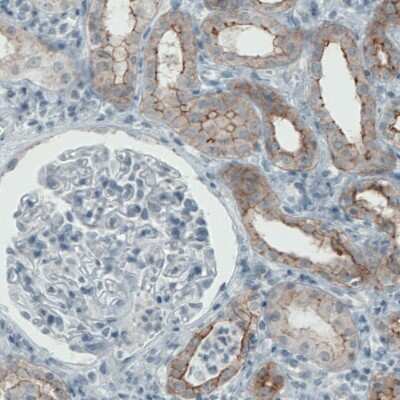 Immunohistochemistry-Paraffin: Occludin Antibody (CL1555) [NBP2-52971] - Staining of human kidney shows membranous positivity in renal tubules.