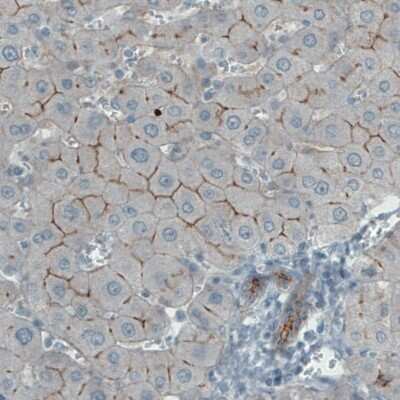 Immunohistochemistry-Paraffin: Occludin Antibody (CL1555) [NBP2-52971] - Staining of human liver shows membranous immunoreactivity in hepatocytes.