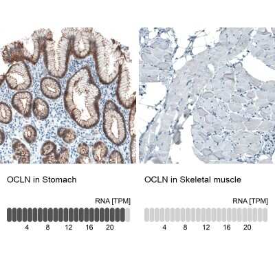 Immunohistochemistry-Paraffin: Occludin Antibody (CL1555) [NBP2-52971] - Analysis in human stomach and skeletal muscle tissues using NBP2-52971 antibody. Corresponding OCLN RNA-seq data are presented for the same tissues.