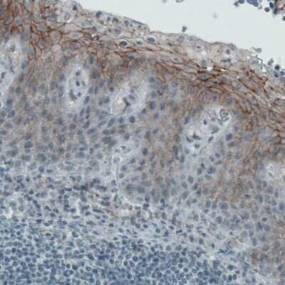 Immunohistochemistry-Paraffin: Occludin Antibody (CL1567) [NBP2-52972] - Staining of human tonsil shows membranous immunoreactivity in squamous epithelium cells.