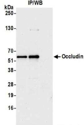 Immunoprecipitation: Occludin Antibody [NBP3-14709] - Whole cell lysate (1.0 mgper IP reaction; 20% of IP loaded) from 293T cells preparedusing NETN lysis buffer. Antibodies: Rabbit anti-Occludinrecombinant monoclonal antibody used for IP at 20 ul/mg lysate. Occludin was alsoimmunoprecipitated by rabbit anti-Occludin antibody. For blotting immunoprecipitated Occludin, was used at 1:1000. Chemiluminescence withan exposure time of 10 seconds.