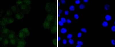 Immunocytochemistry/Immunofluorescence: Oct-3/4 Antibody (SD0750) [NBP2-67748] - Staining Oct4 in N2A cells (green). The nuclear counter stain is DAPI (blue). Cells were fixed in paraformaldehyde, permeabilised with 0.25% Triton X100/PBS.