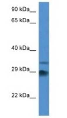 Western Blot Odf1 Antibody - BSA Free