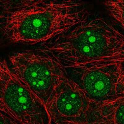 Immunocytochemistry/Immunofluorescence: Olfactomedin-1/Noelin-1 Antibody [NBP2-33836] - Immunofluorescent staining of human cell line MCF7 shows localization to nucleus & nucleoli.