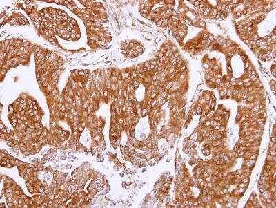 Immunohistochemistry-Paraffin: Olfactomedin-1/Noelin-1 Antibody [NBP1-31163] -  Paraffin-embedded NCI-N87 xenograft, using antibody at 1:100 dilution.