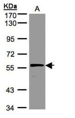 Western Blot: Olfactomedin-1/Noelin-1 Antibody [NBP1-31163] - Sample(30 ug of whole cell lysate)A:Hep G2 7.5% SDS PAGE, antibody diluted at 1:500.