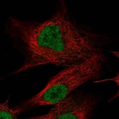 Immunocytochemistry/Immunofluorescence: Olfactomedin-2/Noelin-2 Antibody [NBP2-56884] - Staining of human cell line A549 shows localization to nucleoplasm.