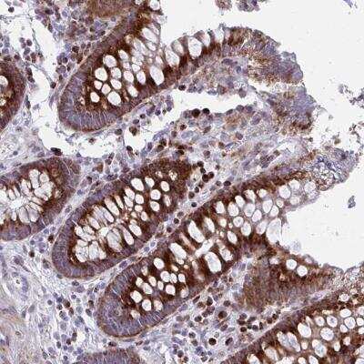 Immunohistochemistry-Paraffin: Olfactomedin-2/Noelin-2 Antibody [NBP2-31692] - OLFM2 Antibody [NBP2-31692] - Staining of human colon shows strong cytoplasmic positivity in glandular cells.