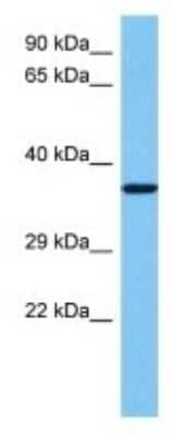 Western Blot: Olfactory Receptor 10 Antibody [NBP3-10244] - Western blot analysis of Olfactory Receptor 10 in Mouse Stomach lysates. Antibody dilution at 1ug/ml