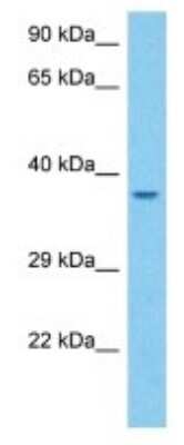 Western Blot: Olfactory Receptor 5 Antibody [NBP3-10267] - Western blot analysis of Olfactory Receptor 5 in Mouse Kidney lysates. Antibody dilution at 1ug/ml