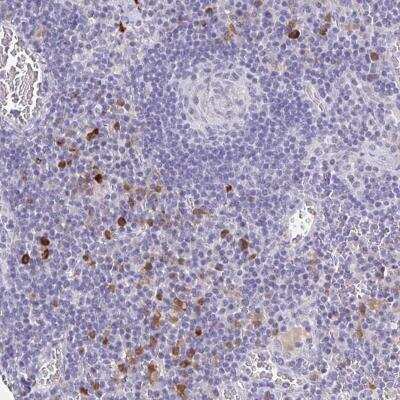 Immunohistochemistry-Paraffin: Olfactory Receptor OR2A4 Antibody [NBP2-46848] - Staining of human lymph node shows strong cytoplasmic positivity in subset of non-germinal center cells.