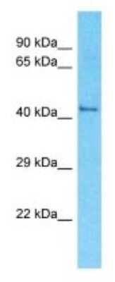 Western Blot: Olfactory Receptor OR52R1 Antibody [NBP3-09869] - Western blot analysis of Olfactory Receptor OR52R1 in HT1080 Whole Cell lysates. Antibody dilution at 1.0ug/ml
