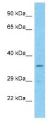 Western Blot Olfactory Receptor OR7E24 Antibody - BSA Free