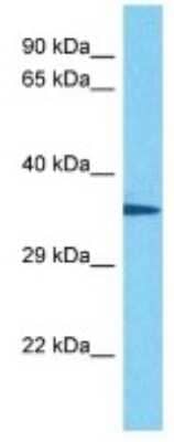 Western Blot: Olfactory receptor 139 Antibody [NBP3-10258] - Western blot analysis of Olfactory receptor 139 in Mouse Lung lysates. Antibody dilution at 1ug/ml